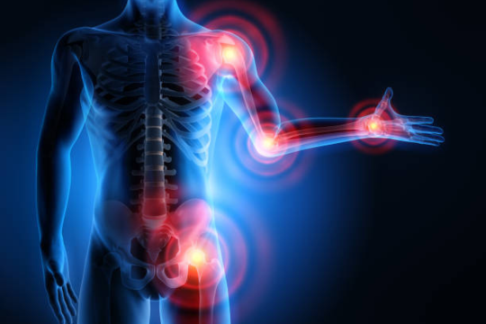 Top Foods Causing Chronic Inflammation in Women and Men – Avoid These Now!